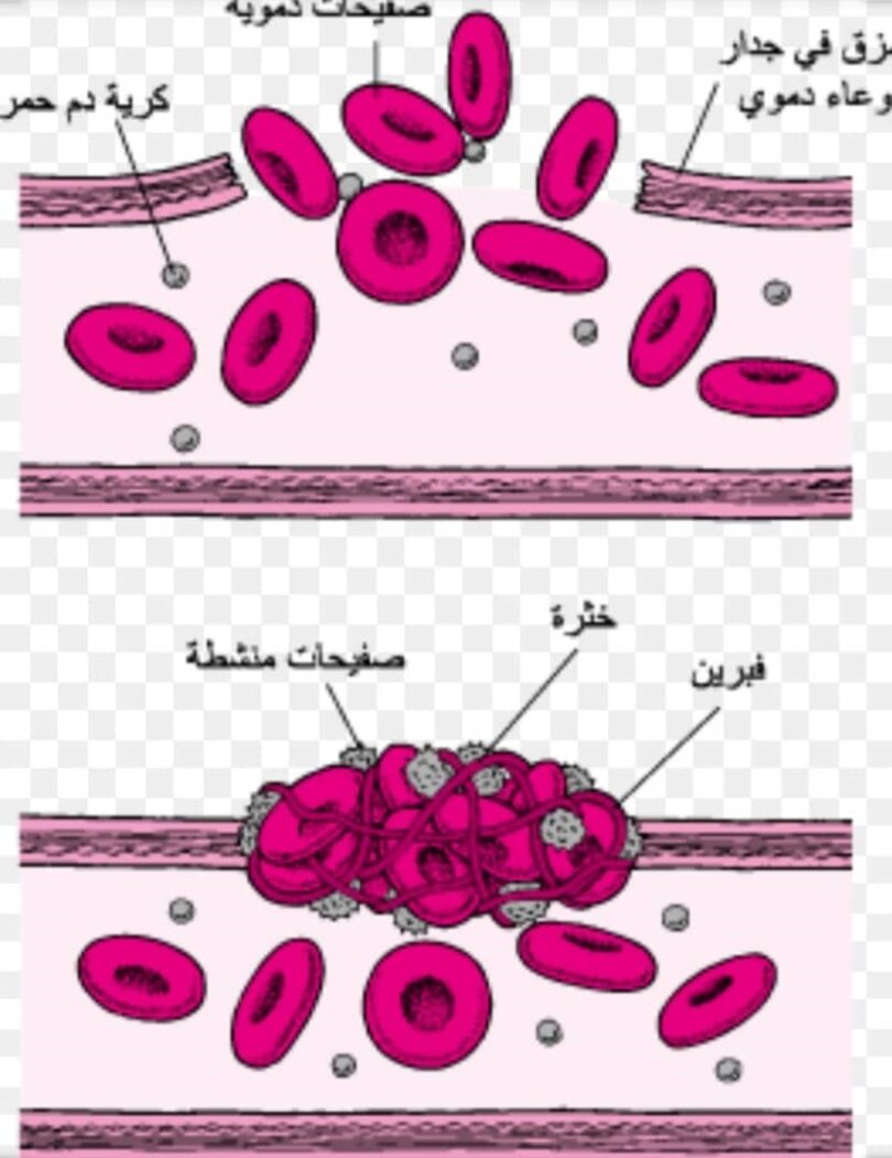 تخثر الدم 1 جريدة حمص